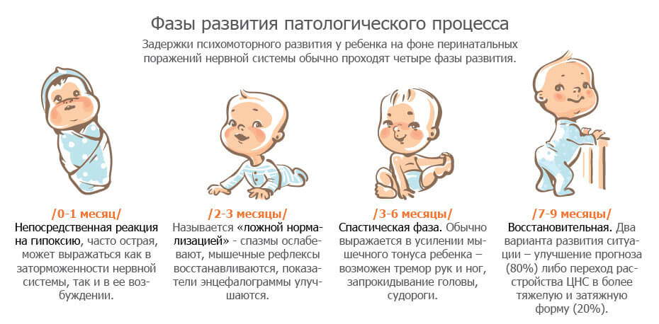 «У новорожденного трясутся подбородок и конечности - это нормально?»